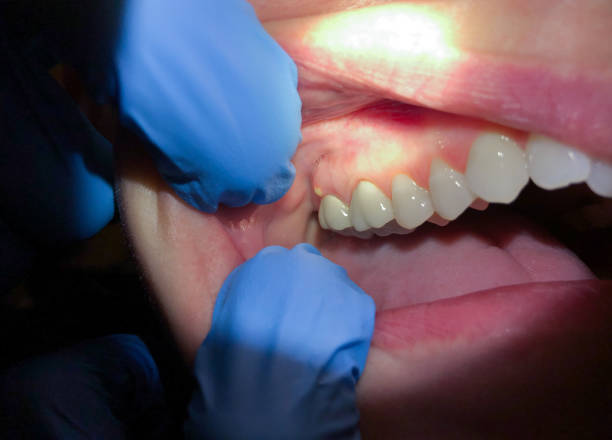 Best Emergency Broken Tooth Repair in Loganville, PA