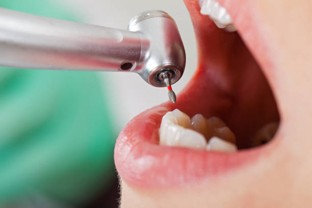 Best Emergency Broken Tooth Repair in Loganville, PA